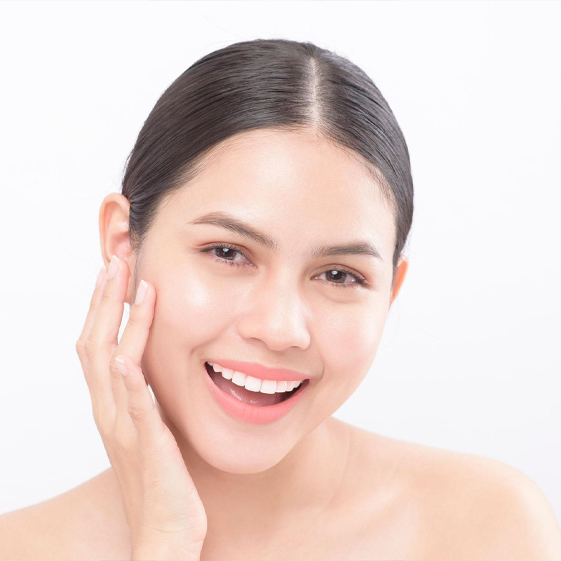 Veneers Results